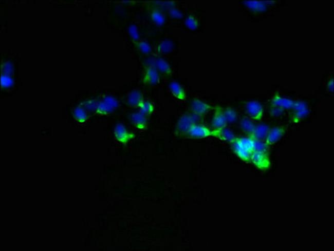 NDFIP1 Antibody in Immunocytochemistry (ICC/IF)