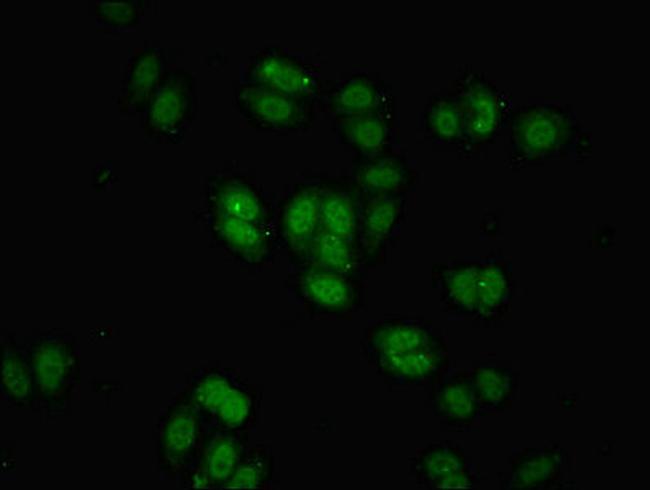 BRD9 Antibody in Immunocytochemistry (ICC/IF)