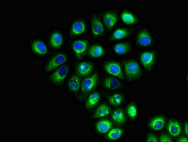 SLC6A13 Antibody in Immunocytochemistry (ICC/IF)