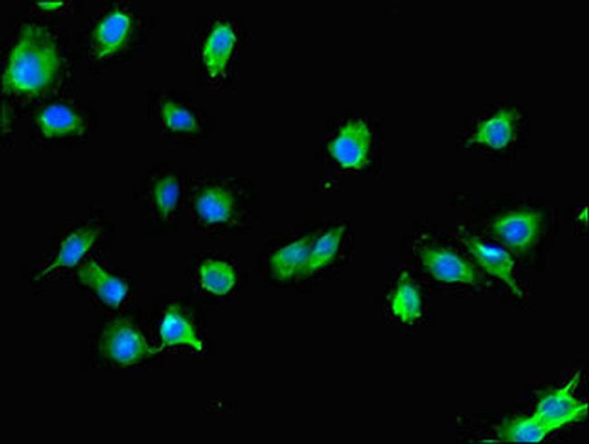 USE1 Antibody in Immunocytochemistry (ICC/IF)