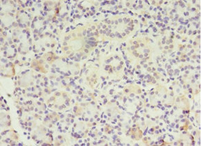 MTRR Antibody in Immunohistochemistry (Paraffin) (IHC (P))