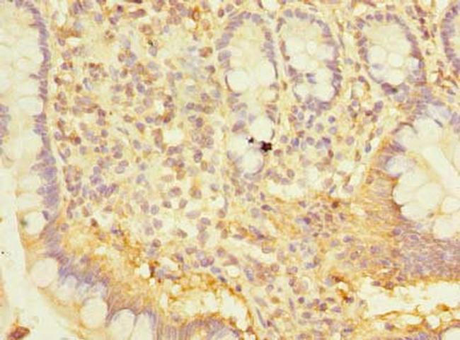 SNX6 Antibody in Immunohistochemistry (Paraffin) (IHC (P))