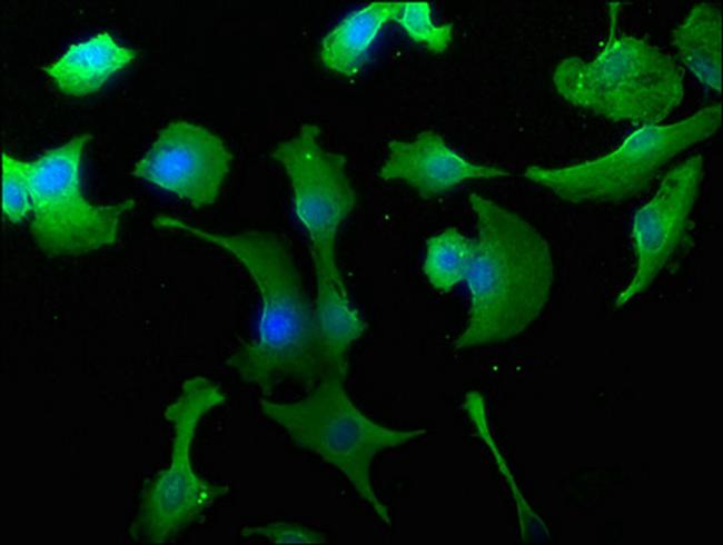 WWC3 Antibody in Immunocytochemistry (ICC/IF)