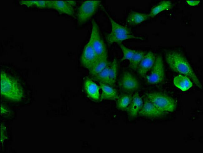 SHOC2 Antibody in Immunocytochemistry (ICC/IF)