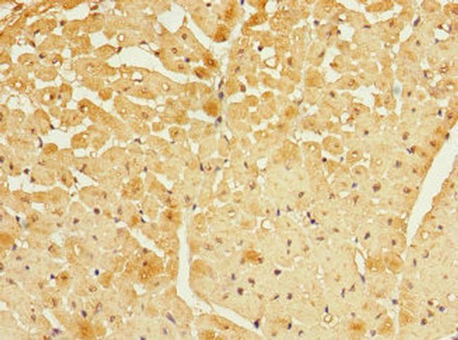 FBXO4 Antibody in Immunohistochemistry (Paraffin) (IHC (P))