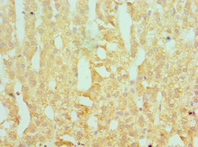 SERPINA10 Antibody in Immunohistochemistry (Paraffin) (IHC (P))