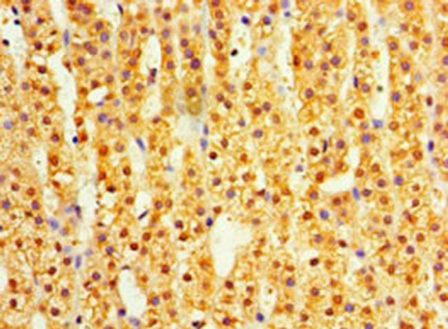 DIMT1 Antibody in Immunohistochemistry (Paraffin) (IHC (P))