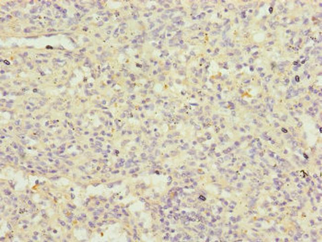 FBXL5 Antibody in Immunohistochemistry (Paraffin) (IHC (P))