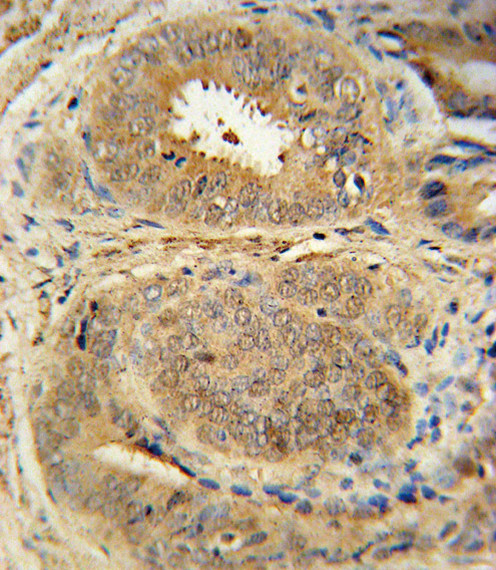 MDM2 Antibody in Immunohistochemistry (Paraffin) (IHC (P))