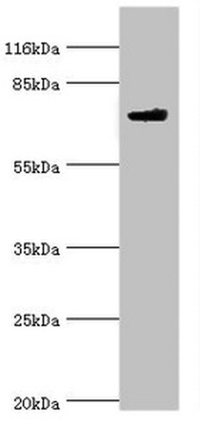 MTMR7 Antibody in Western Blot (WB)