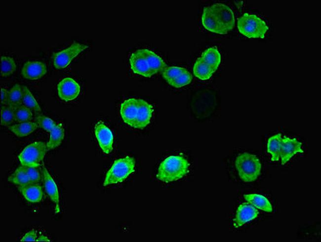 CEP83 Antibody in Immunocytochemistry (ICC/IF)