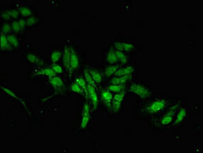 MAB21L2 Antibody in Immunocytochemistry (ICC/IF)