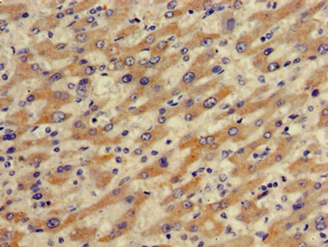 OATP2 Antibody in Immunohistochemistry (Paraffin) (IHC (P))