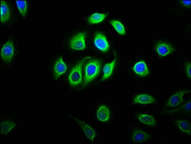 C11orf9 Antibody in Immunocytochemistry (ICC/IF)