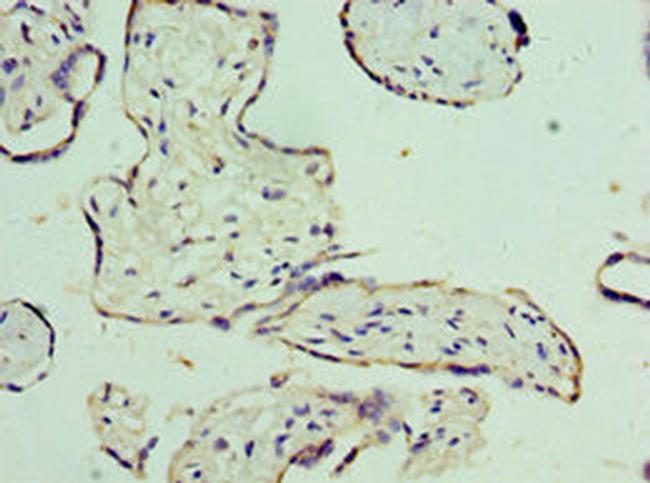 ORNT1 Antibody in Immunohistochemistry (Paraffin) (IHC (P))