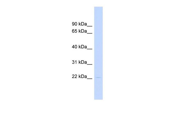 HAND1 Antibody in Western Blot (WB)