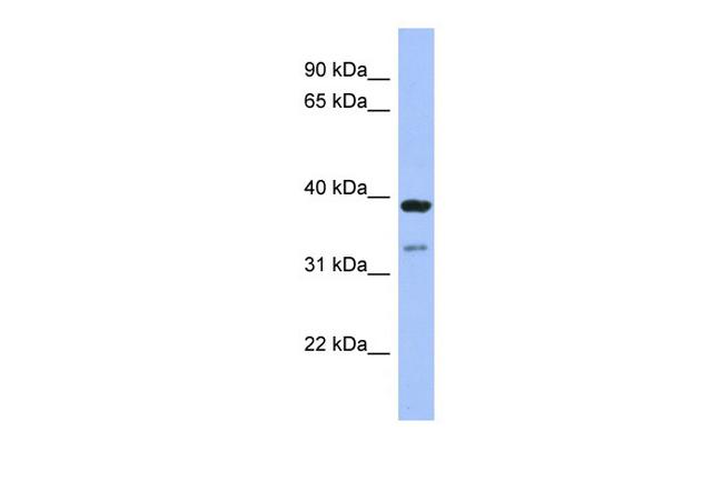 RASSF7 Antibody in Western Blot (WB)