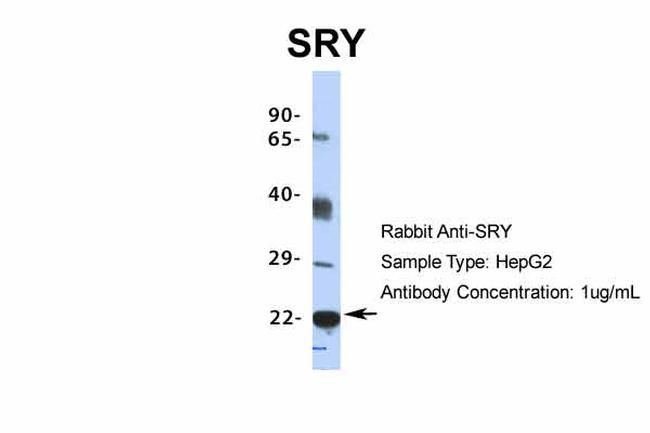 SRY Antibody in Western Blot (WB)