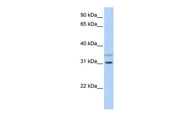 KCNRG Antibody in Western Blot (WB)