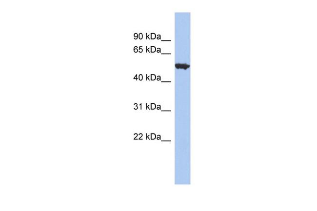 ASIC2 Antibody in Western Blot (WB)