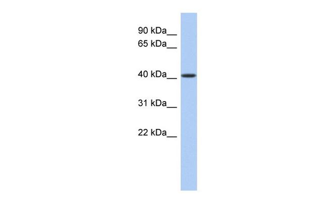 Lass5 Antibody in Western Blot (WB)