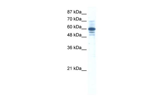 ZNF276 Antibody in Western Blot (WB)