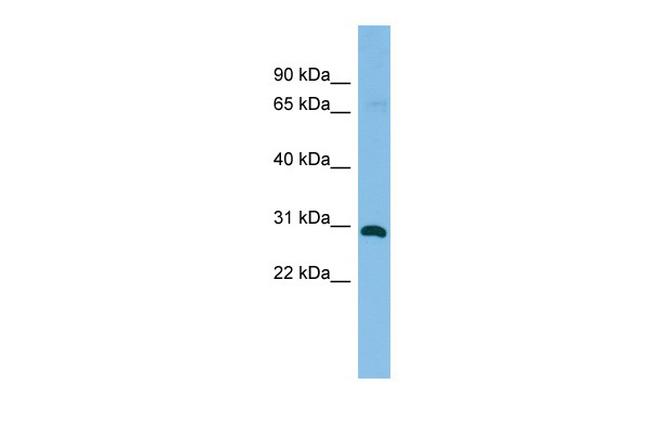 Hex Antibody in Western Blot (WB)