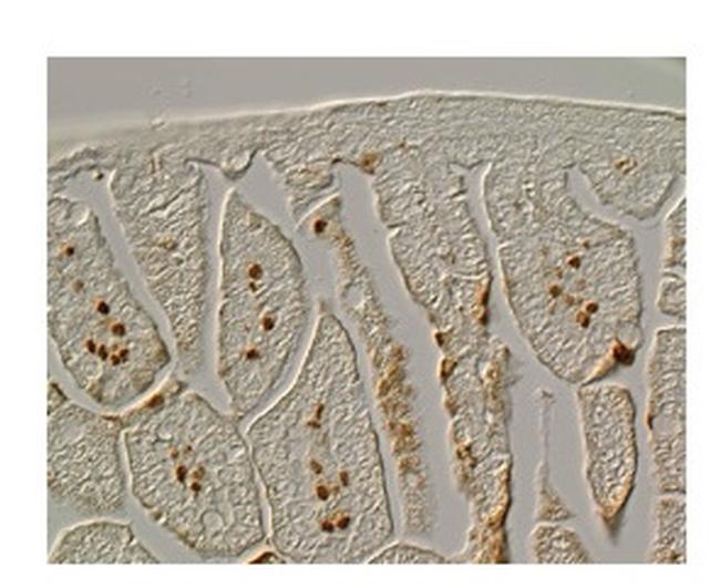 FOXF1 Antibody in Immunohistochemistry (IHC)