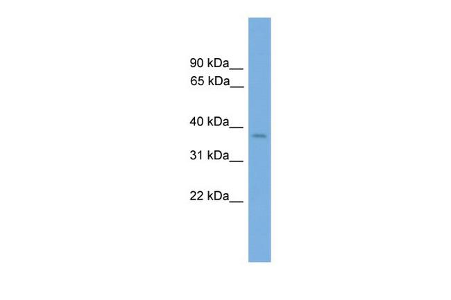 SIX3 Antibody in Western Blot (WB)