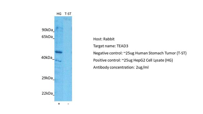 TEF5 Antibody in Western Blot (WB)