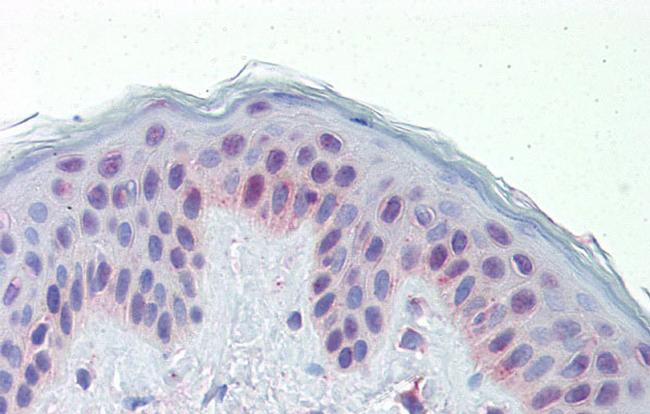 TR2 Antibody in Immunohistochemistry (IHC)