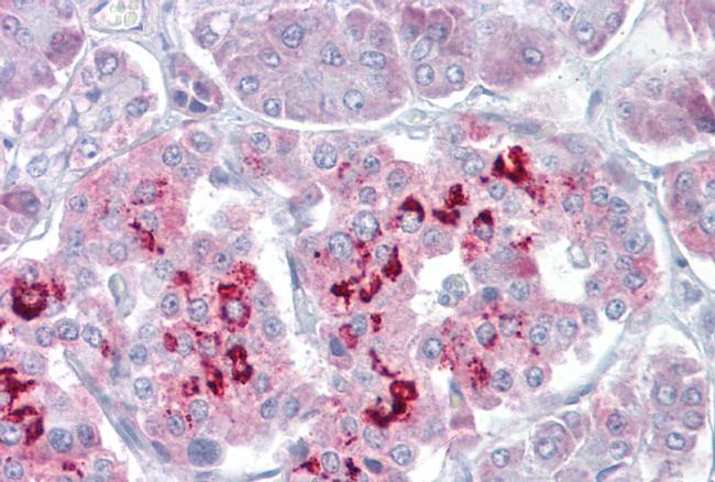 SIM1 Antibody in Immunohistochemistry (IHC)