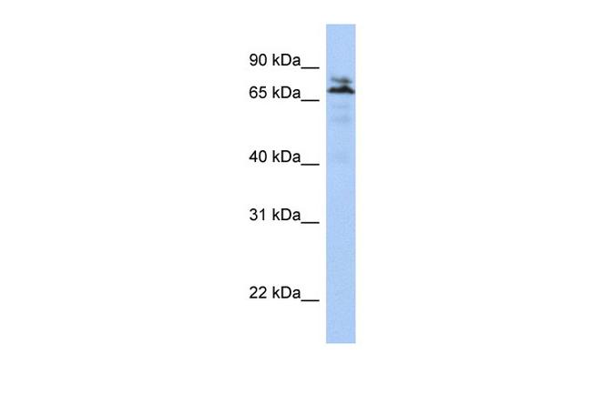 MYST2 Antibody in Western Blot (WB)