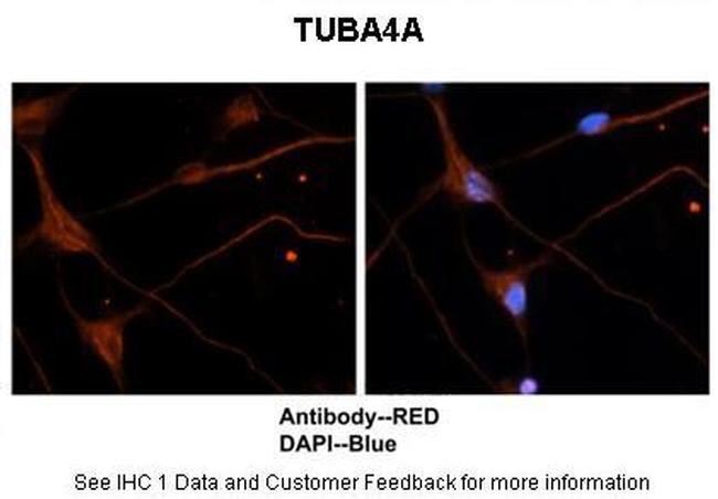 TUBA4A Antibody in Immunohistochemistry (IHC)