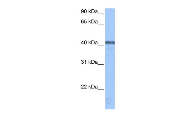 APOBEC3F Antibody in Western Blot (WB)