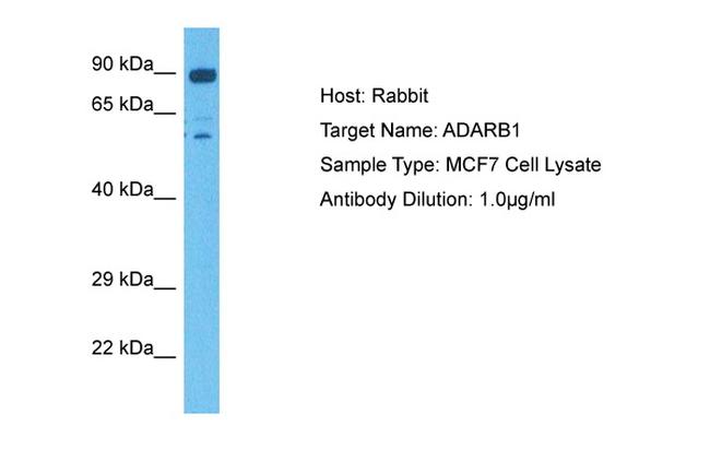 ADARB1 Antibody in Western Blot (WB)