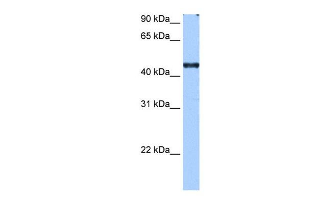 RBM42 Antibody in Western Blot (WB)