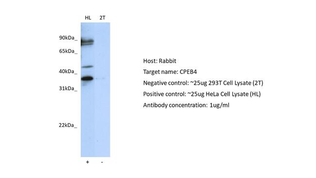 CPEB4 Antibody in Western Blot (WB)