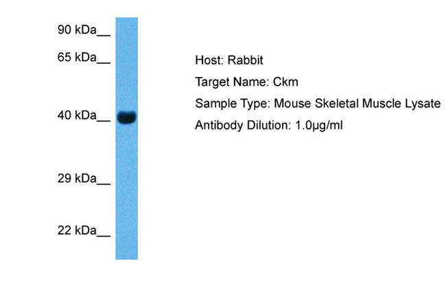 Creatine Kinase MB Antibody in Western Blot (WB)