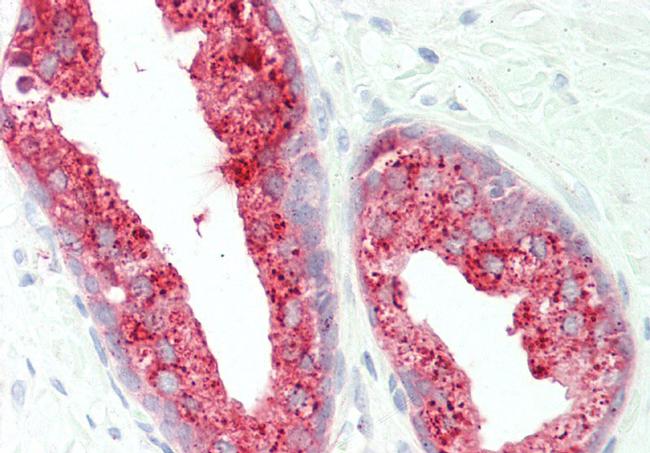 Prostate Specific Acid Phosphatase Antibody in Immunohistochemistry (Paraffin) (IHC (P))