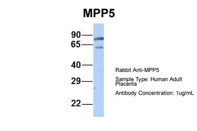 MPP5 Antibody in Western Blot (WB)