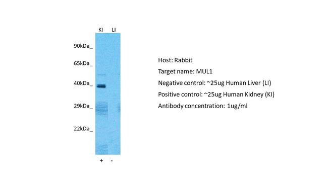 MUL1 Antibody in Western Blot (WB)