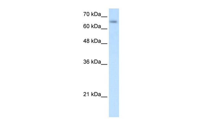 ZIP12 Antibody in Western Blot (WB)