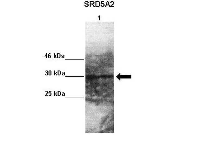 SRD5A2 Antibody in Western Blot (WB)