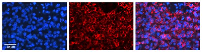 PSEN2 Antibody in Immunohistochemistry (Paraffin) (IHC (P))