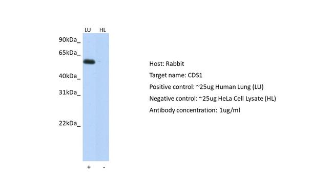 CDS1 Antibody in Western Blot (WB)