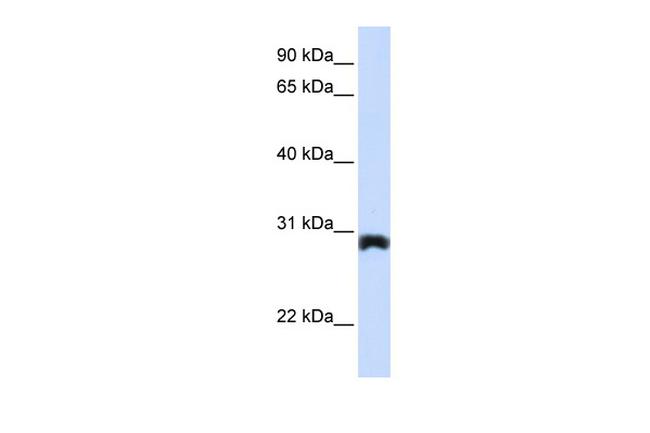 PEX11A Antibody in Western Blot (WB)