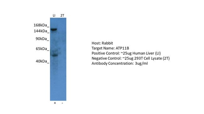 ATP11B Antibody in Western Blot (WB)