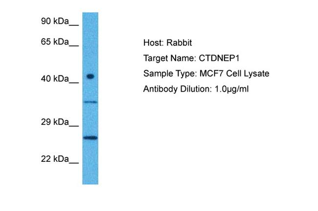 DULLARD Antibody in Western Blot (WB)