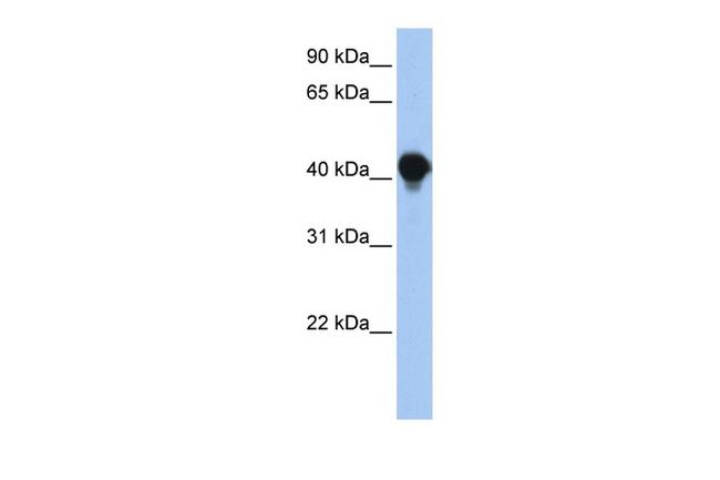 PTPLAD1 Antibody in Western Blot (WB)